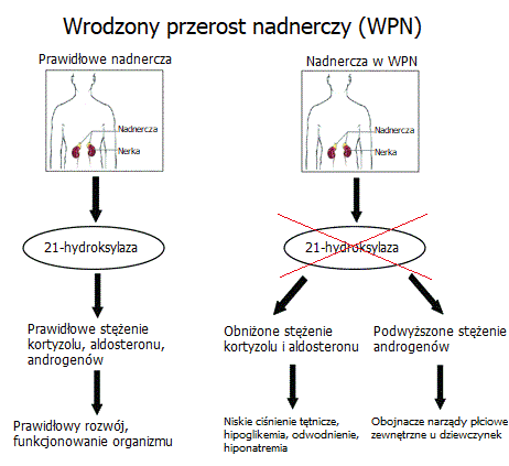 wrodzony przerost nadnerczy pieluchomajtki